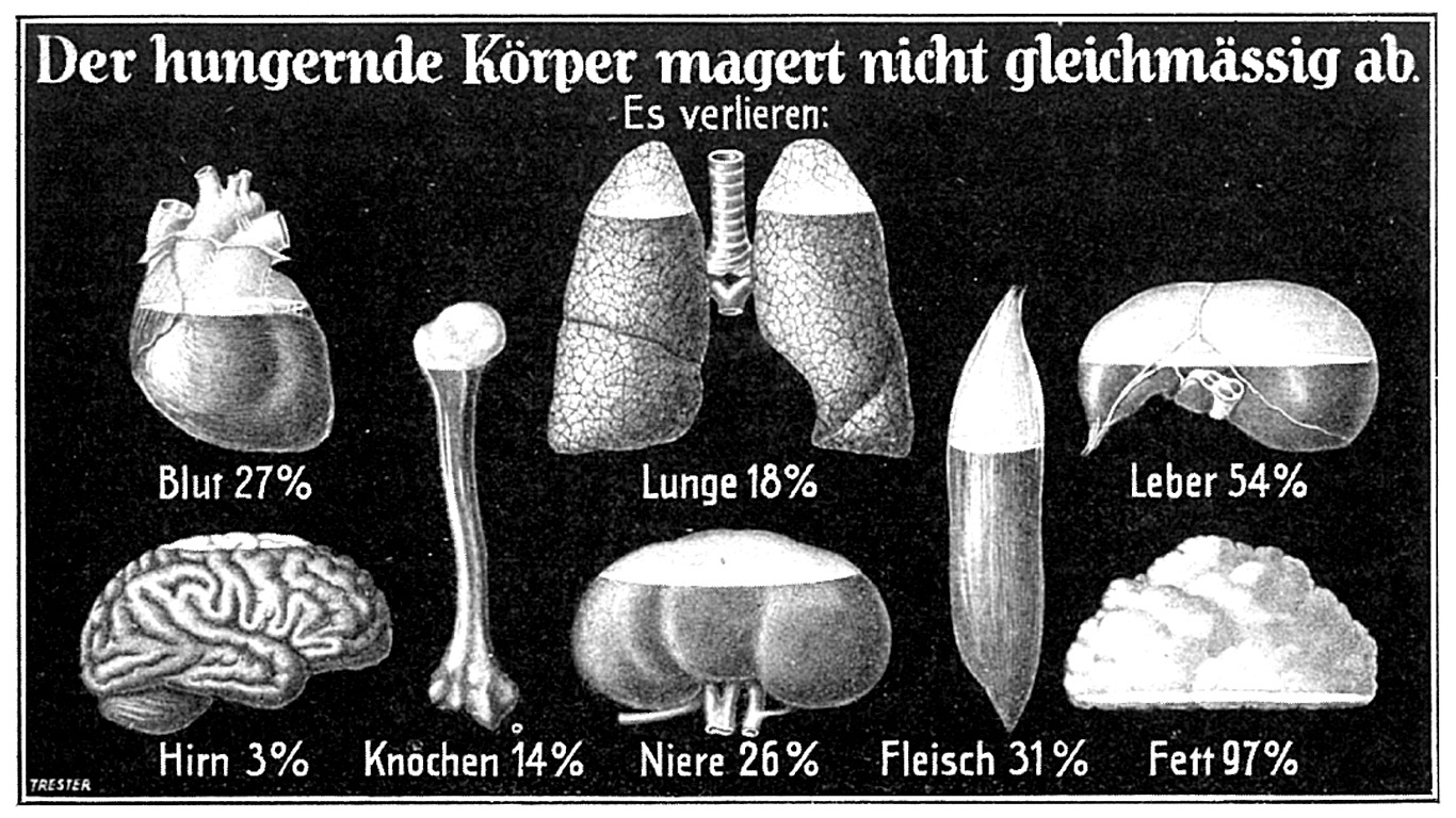 Wo nimmt der Körper ab? (1926)
