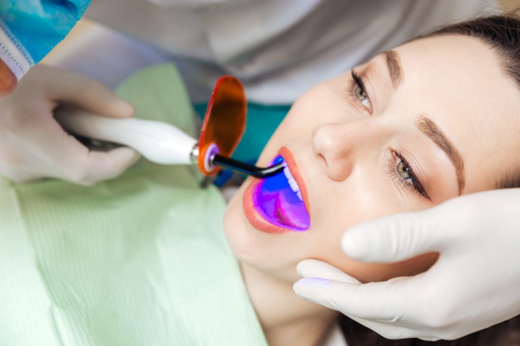 Gesunde Zähne: Wie schädlich ist Bleaching? - Welt der Wunder