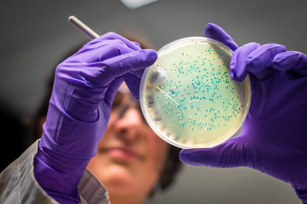 Salmonellenvergiftung: Eine Bakterienkolonie in einer Petrischale