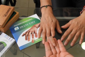 Dianceht: Realistische Prothesen für ein Leben ohne Einschränkungen