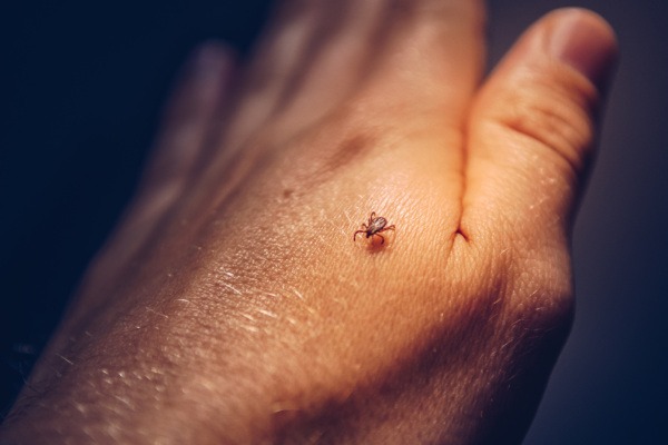 Häufig übersehene Erkrankungen – das macht die Diagnose schwierig: Zecken als Überträger von Borreliose