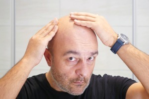 Haarausfall lässt sich bald rückgängig machen