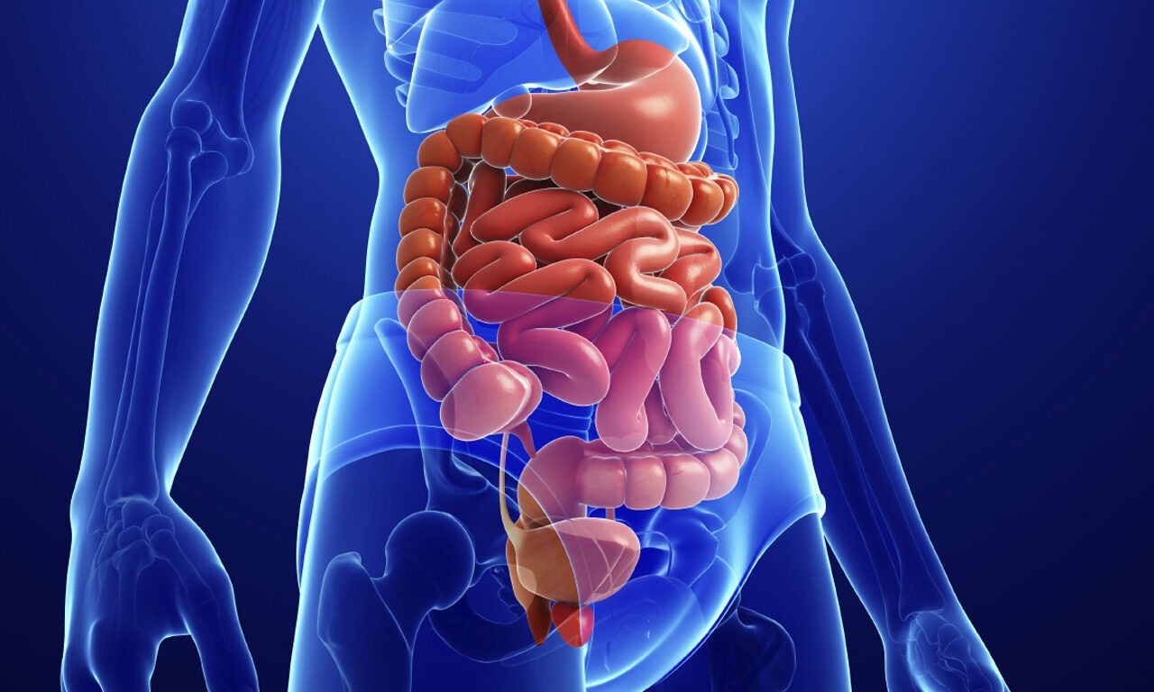 Was genau ist Morbus Crohn?