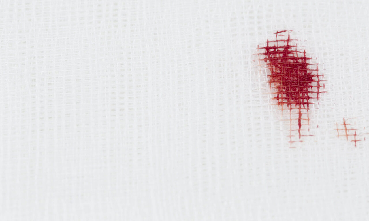 Trick 2: Blut entfernen