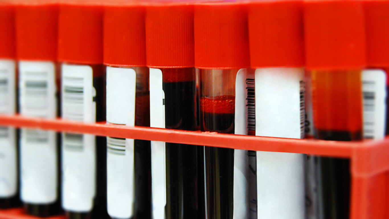 Was passiert nach der Spende mit dem Blut?