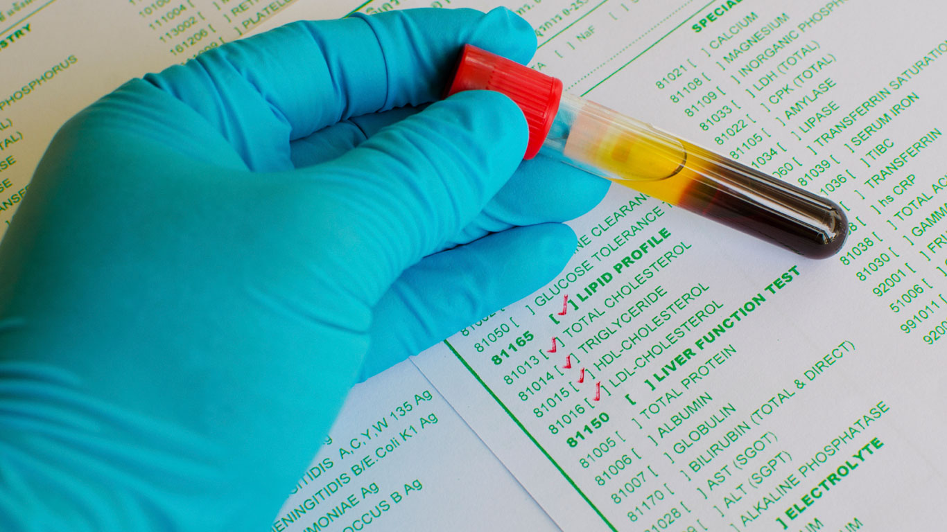 Cholesterin ist nicht gleich Cholesterin