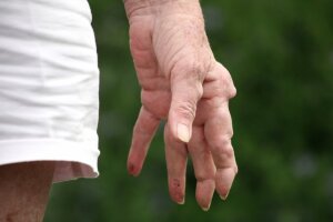Was steckt hinter der Diagnose „Rheumatismus“?